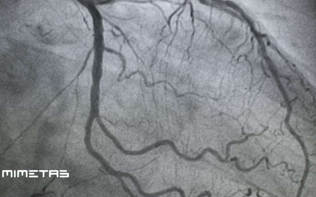 MIMETAS publishes breakthrough study on human artery-on-a-chip model