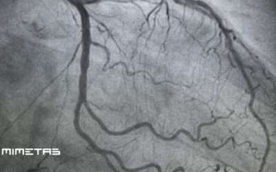 MIMETAS publishes breakthrough study on human artery-on-a-chip model