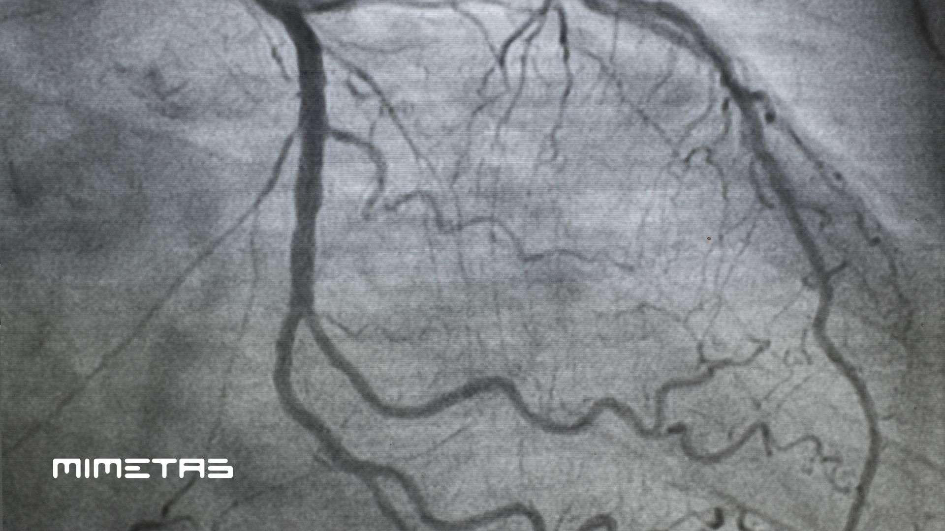MIMETAS publishes breakthrough study on human artery-on-a-chip model