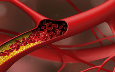 Over €900,000 for new treatment against atherosclerosis