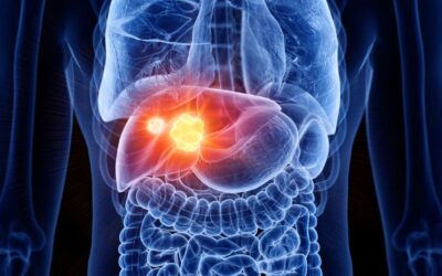 Levels Dx Raises New Investment to Advance Clinical Validation of Early-Stage Liver Cancer Test