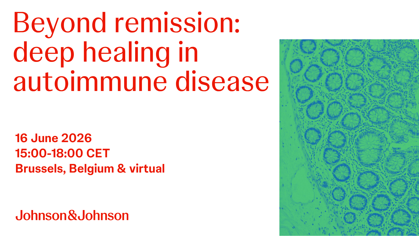 Beyond remission: deep healing in autimmune disease